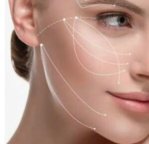 Pose de fils tenseurs résorbables sur le visage à Grenoble